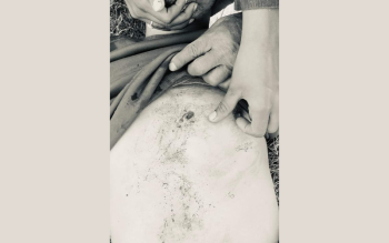 बाजुरामा प्रहरीको गोलीबाट एकको मृत्यु, ५ जना घाइतेको हेलिकोप्टबाट उद्धार